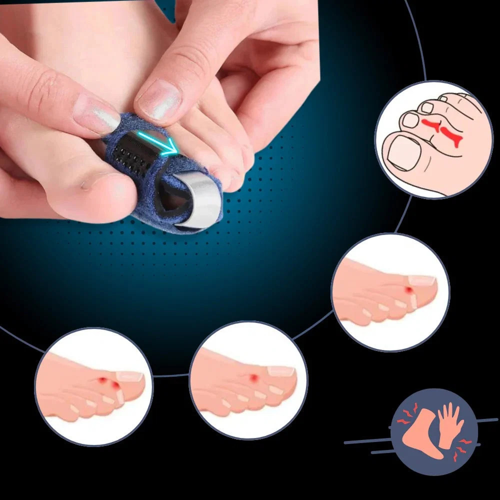 toe-straightener-with-adjustable-support-41193616_3.jpg